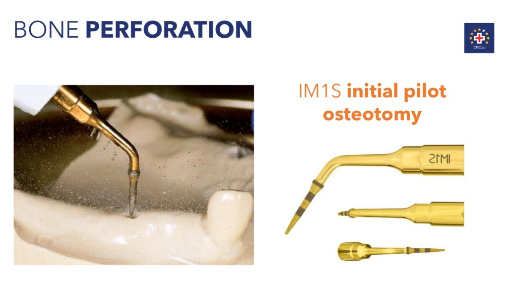 congresso-internazionale-implantologia-ceramica-pag-41