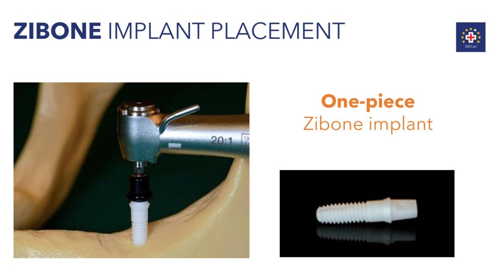 congresso-internazionale-implantologia-ceramica-pag-48