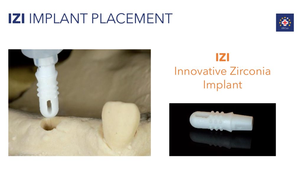 congresso-internazionale-implantologia-ceramica-pag-50
