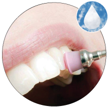lucidatura-denti-ozono